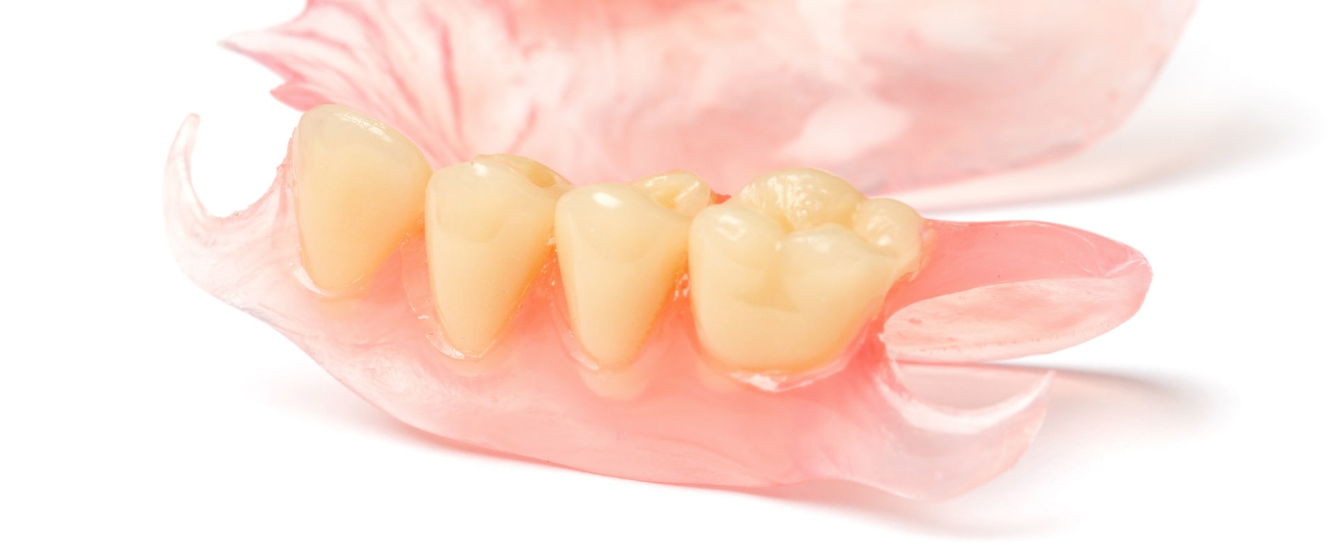 Are Prosthodontics Dentures? A Comprehensive Guide