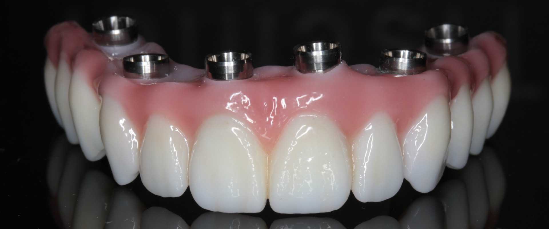 Do prosthodontists pull teeth?