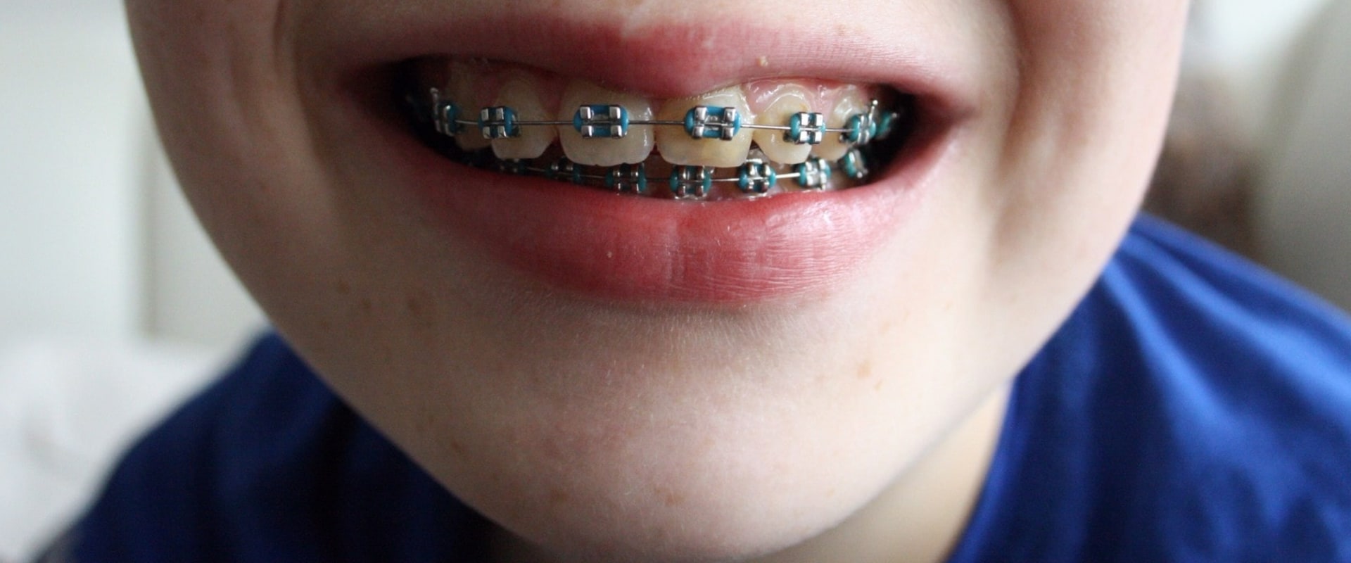 Can prosthodontist do braces?