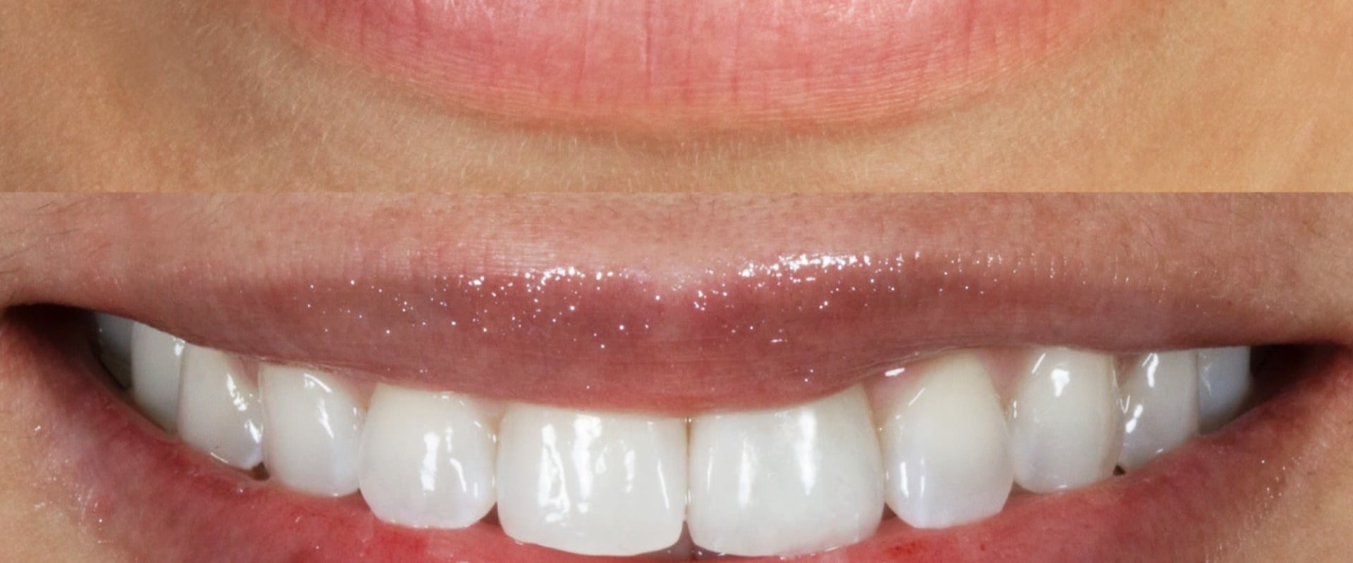 Song Cosmetic Dentistry: Prosthodontist in Beverly Hills