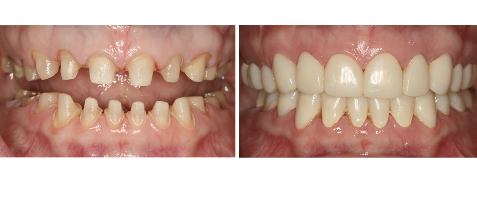 Is it hard to become a prosthodontist?