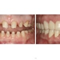 What procedures do prosthodontist do?