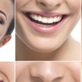What does prosthodontist do?