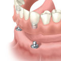 Top-rated prosthodontist near me?