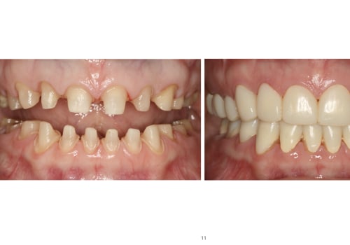 Is being a prosthodontist worth it?