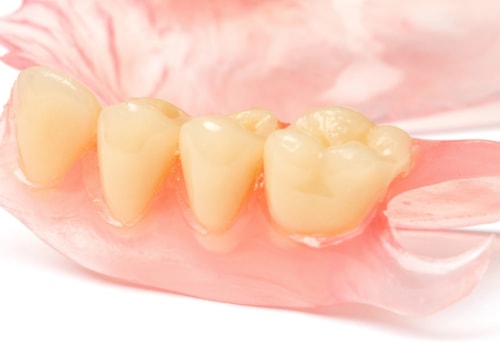 Are prosthodontics dentures?